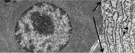 Fig. 39.8, Transmission electron microscopy of a pancreatic acinar cell demonstrating a prominent endoplasmic reticulum (ER). Panel to the right is a magnified image of the ER and shows electron-dense ribosomes dotting the cytosolic face of the ER ( arrowheads ) and the ER lumen which is devoid of ribosomes.