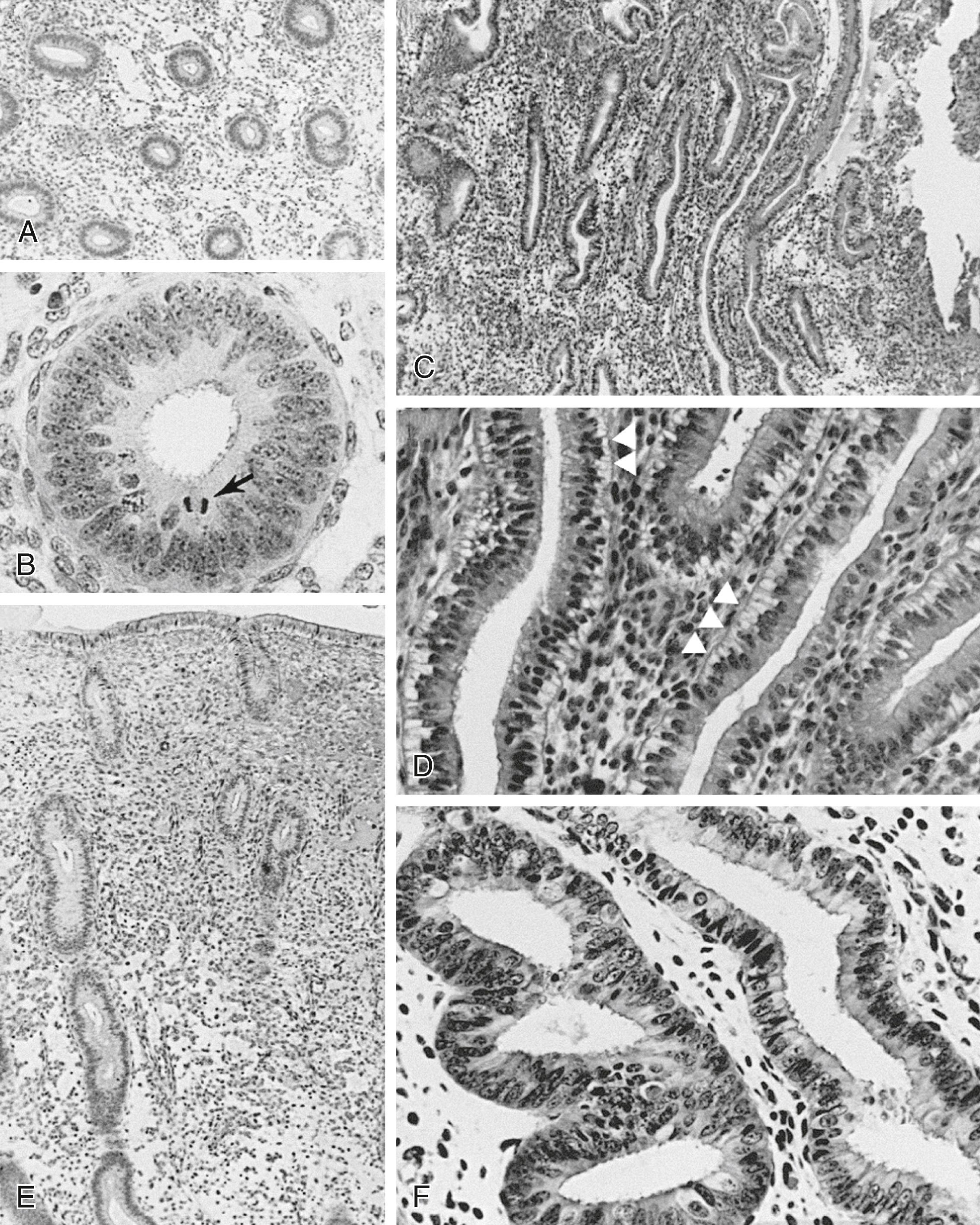 Fig. 10.8, Histology of the endometrium during the menstrual cycle.