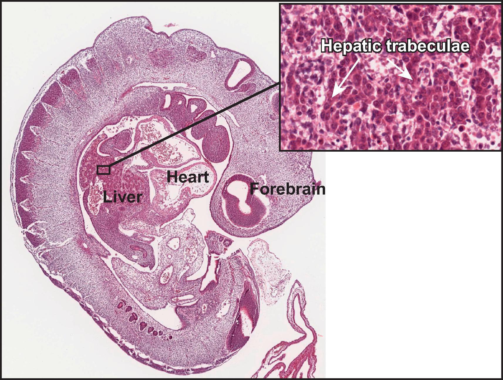 Figure 1.1, Photomicrograph of hepatic primordium in human embryo at 25 days’ gestation. The lower-power view shows the organs of the coelomic cavity. The higher-power inset shows cords of endodermal cells within the mesenchyme of the septum transversum, thus forming the hepatic primordium.