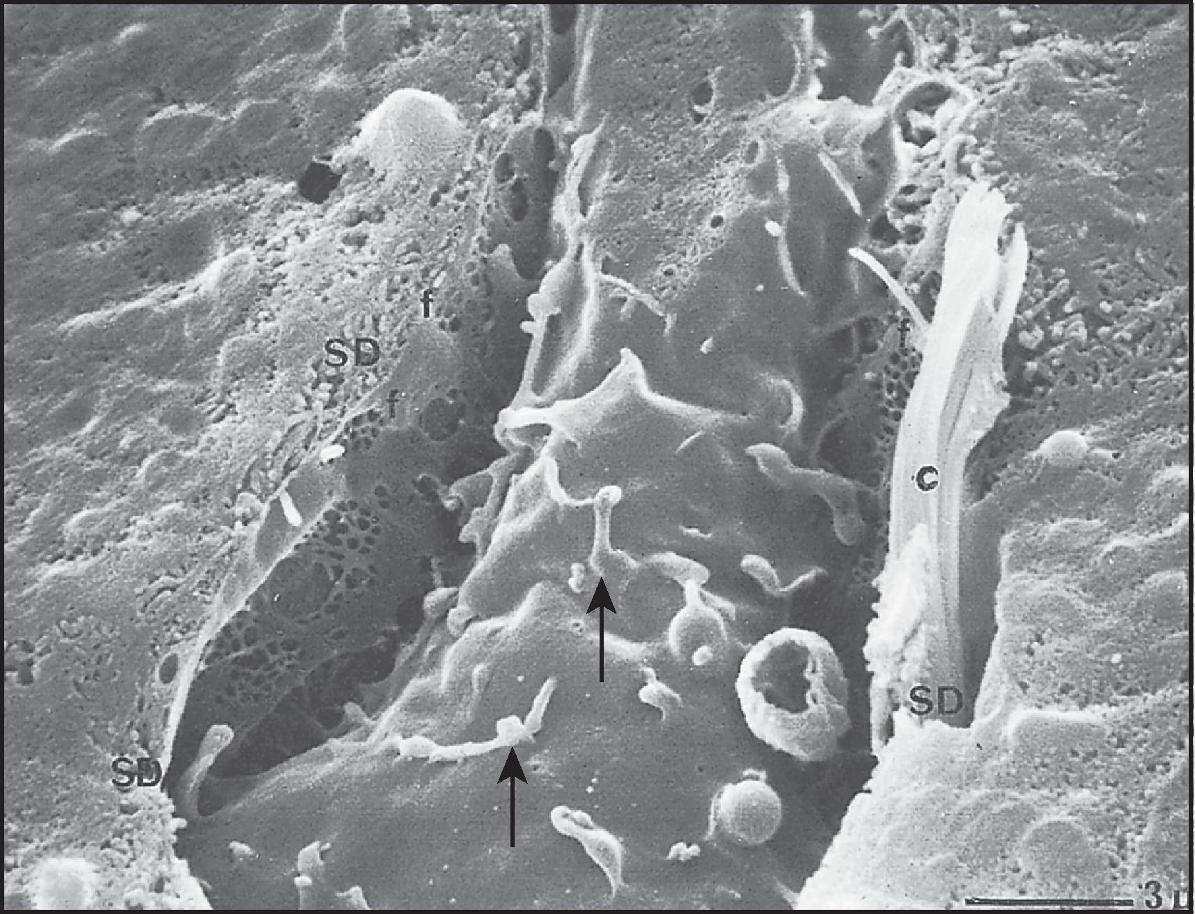 Figure 1.17, Scanning electron microscopy. Part of Kupffer cell lying in a sinusoid and showing characteristic microvilli projecting at the cell surface (arrows). Small rims of fenestrated endothelium can be observed at both sides of the Kupffer cell (f). A small bundle of collagen fibres (c) is situated in the space of Disse (SD) on the right.