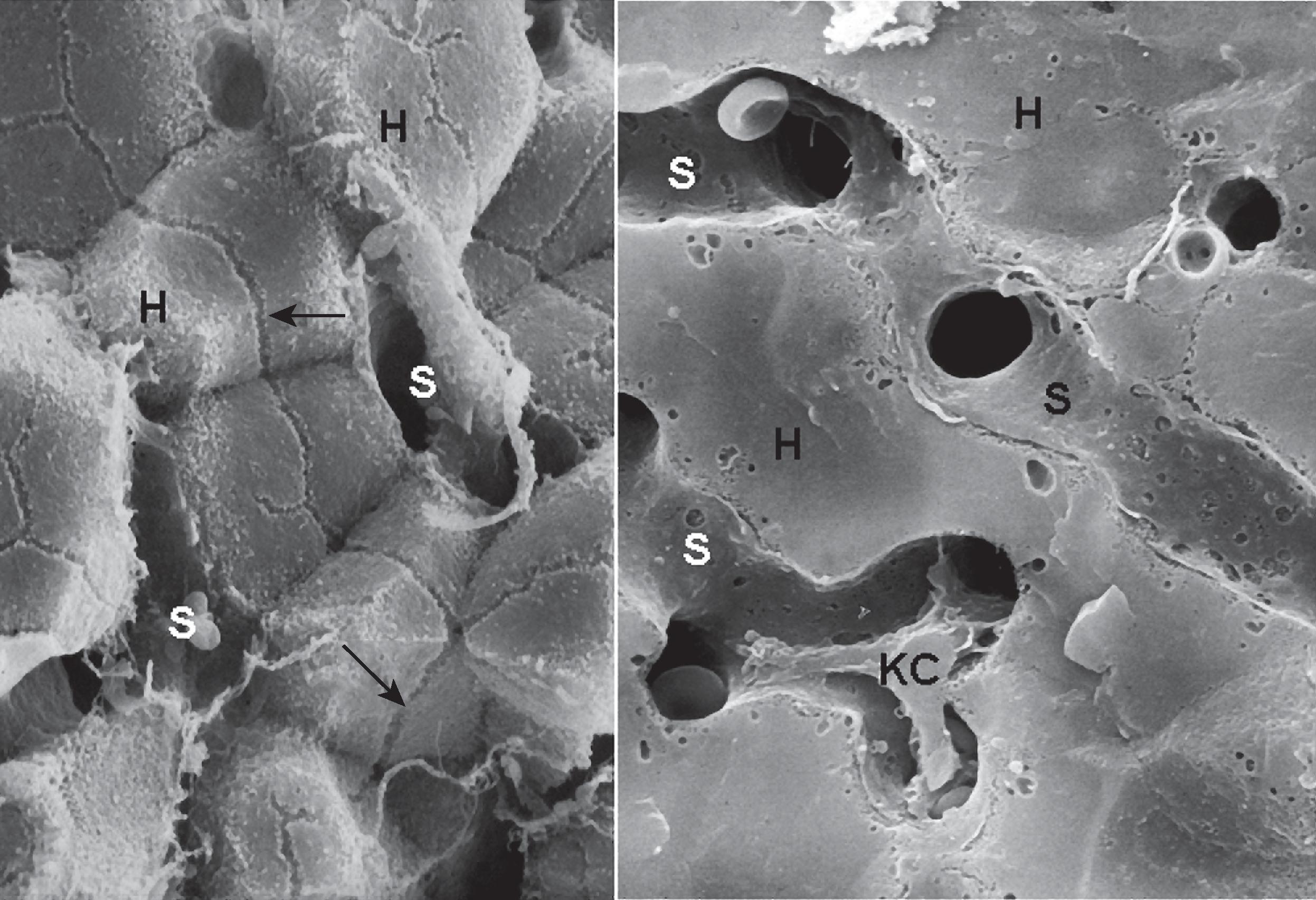 Figure 1.7, Plates of hepatocytes viewed by scanning electron microscopy. (A) The fracture plane highlights the lateral faces of hepatocytes (H) , with bile canaliculi (arrow) in view. The labyrinth of sinusoidal spaces (S) is evident between hepatocyte plates. (B) Different image shows the sinusoidal spaces to better advantage. A Kupffer cell (KC) is present within the luminal space of the sinusoid.