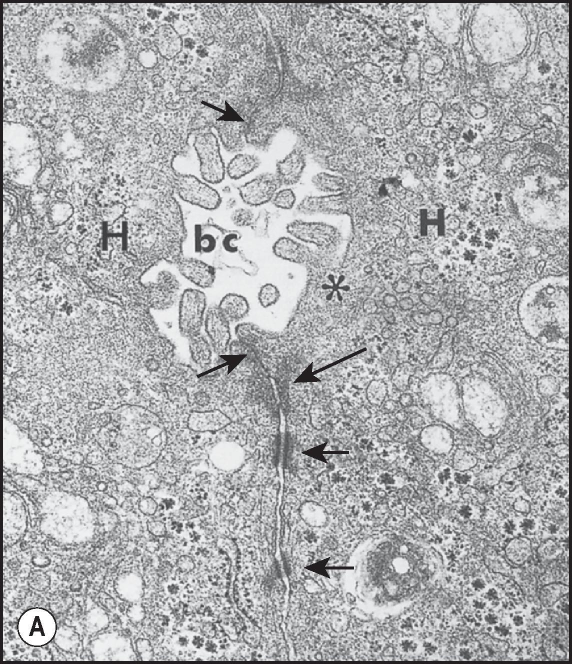 Figure 1.9, (A) Transmission electron micrograph of bile canaliculus (bc) , human liver . Note microvilli projecting into the lumen and the organelle-free pericanalicular cytoplasm (asterisk). Tight junctions and desmosomes (arrows) are present between the two adjacent hepatocytes (H). (B) Scanning electron micrograph. On the surface of a number of neighbouring hepatocytes, an interconnected network of bile hemicanaliculi show bifurcations (arrows) together with blunt ends (asterisks). (C) Bile canaliculi in rabbit liver. Immunofluorescence preparation in which the section was reacted with a human serum containing smooth muscle antibody. The pericanalicular microfilaments have produced strong positive immunofluorescence. (D) CD10 immunoreactivity of canalicular network in normal human liver.