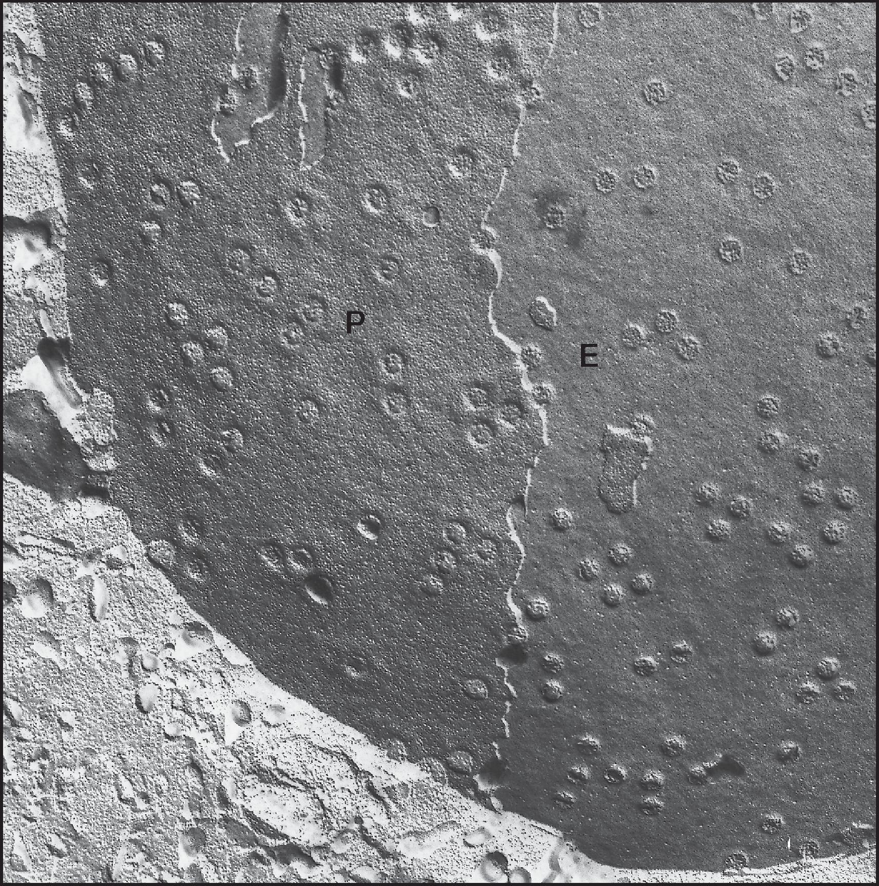 Figure 1.10, Freeze-fracture replica illustrating the inner leaflet ( P face) and the outer leaflet ( E face) of the nuclear membrane of a hepatocyte. Note the numerous nuclear pores. (Human liver, magnification ×44,800.)