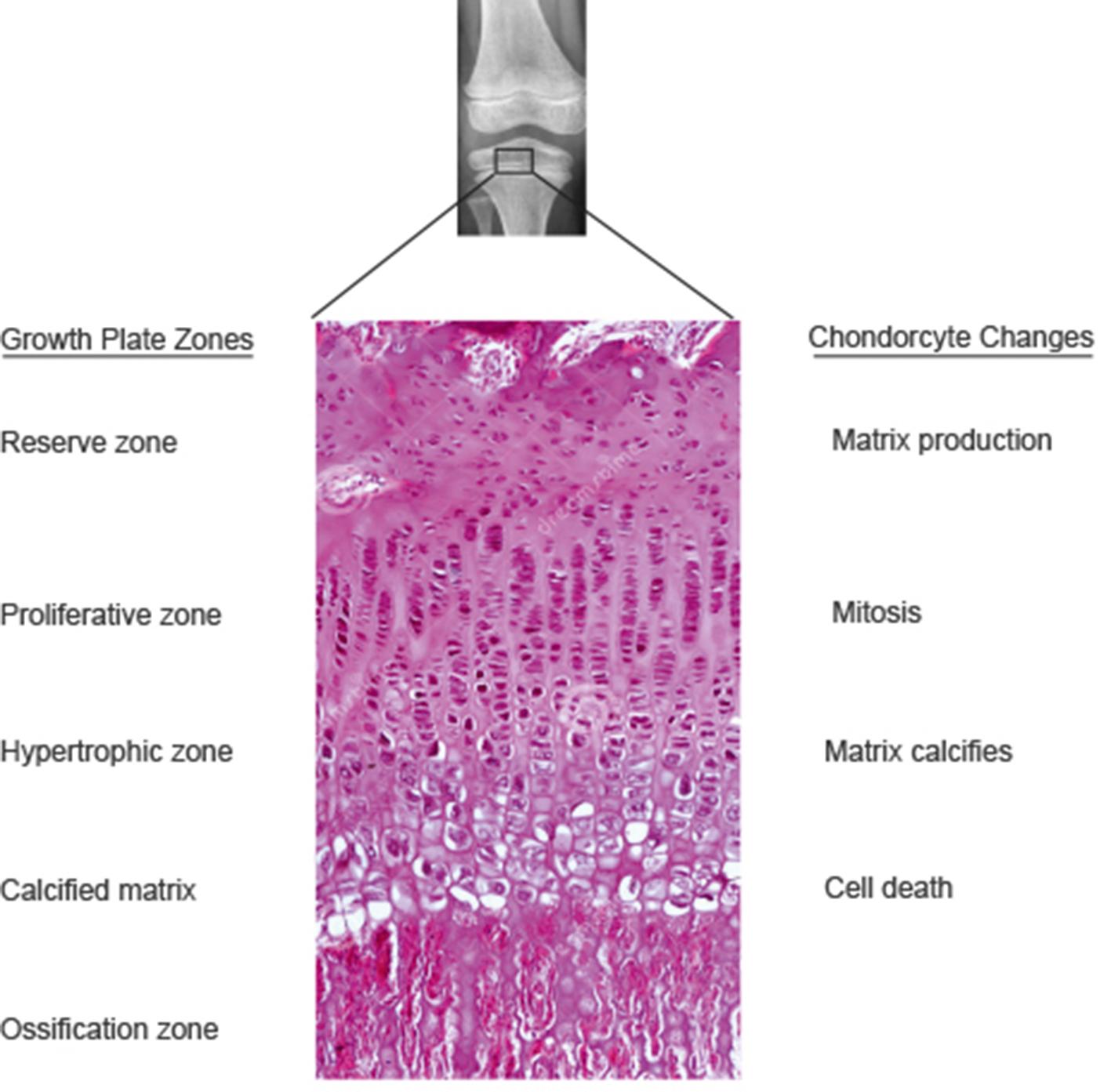 Fig. 1.3, Histology of the epiphysis. Cells at the top, the epiphyseal side, undergo rapid mitosis to increase the thickness of the epiphyseal plate resulting in increased bone length. In the hypertrophic zone, matrix is deposited and, as matrix accumulates, cells in the vicinity die. (The histological image, to which radiograph and labeling have been added, is attributed to the copyright holder, Springer Publishing, and appeared in Horvai A. Anatomy and histology of cartilage In TM Links, Editor, Cartilage Imaging, Springer, 2011, Figure 1-8. Reprinted with permission.)