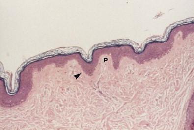 Figure 2.3, Histologic appearance of normal skin.