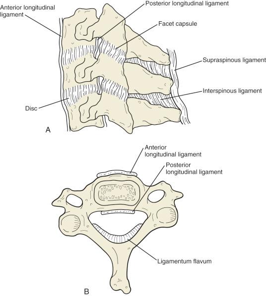 Fig. 32.3, Ligamentous anatomy of the subaxial cervical spine when viewed from laterally (A) and from above (B).