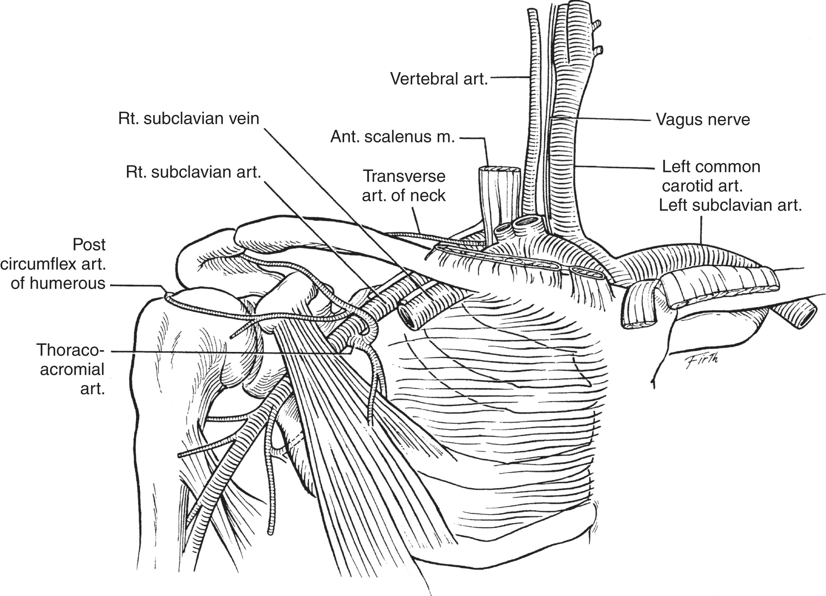 FIGURE 1, Anatomy of subclavian vessels.