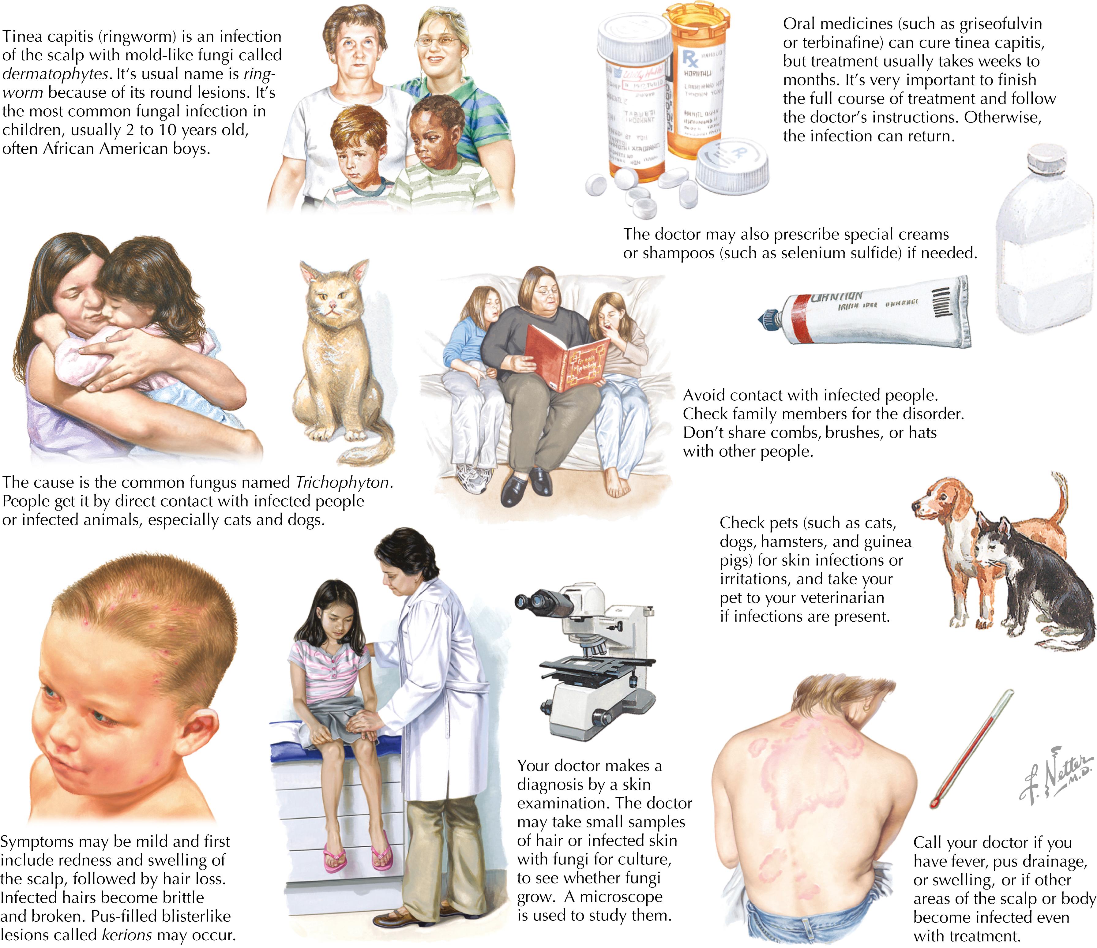 Fig. 22.1, Managing tinea capitis.