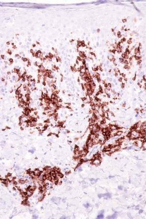 Fig. 8.7, Chronic superficial dermatitis: in this example, there is no significant loss of CD7 expression.