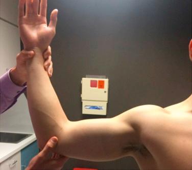 Fig. 42.3, Range of motion is assessed in all planes. Here the examiner is assessing external rotation with the arm abducted to 90 degrees. Both shoulders are examined to look for differences.