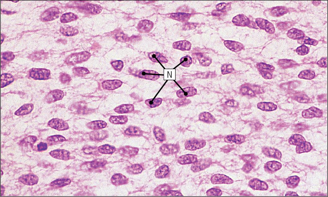 Fig. 4.1, Embryonic Mesenchyme.