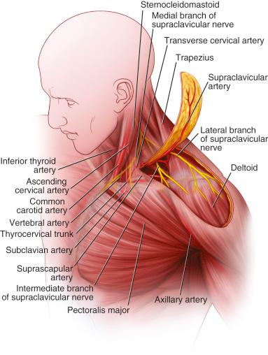 Figure 33.1, Supraclavicular flap.