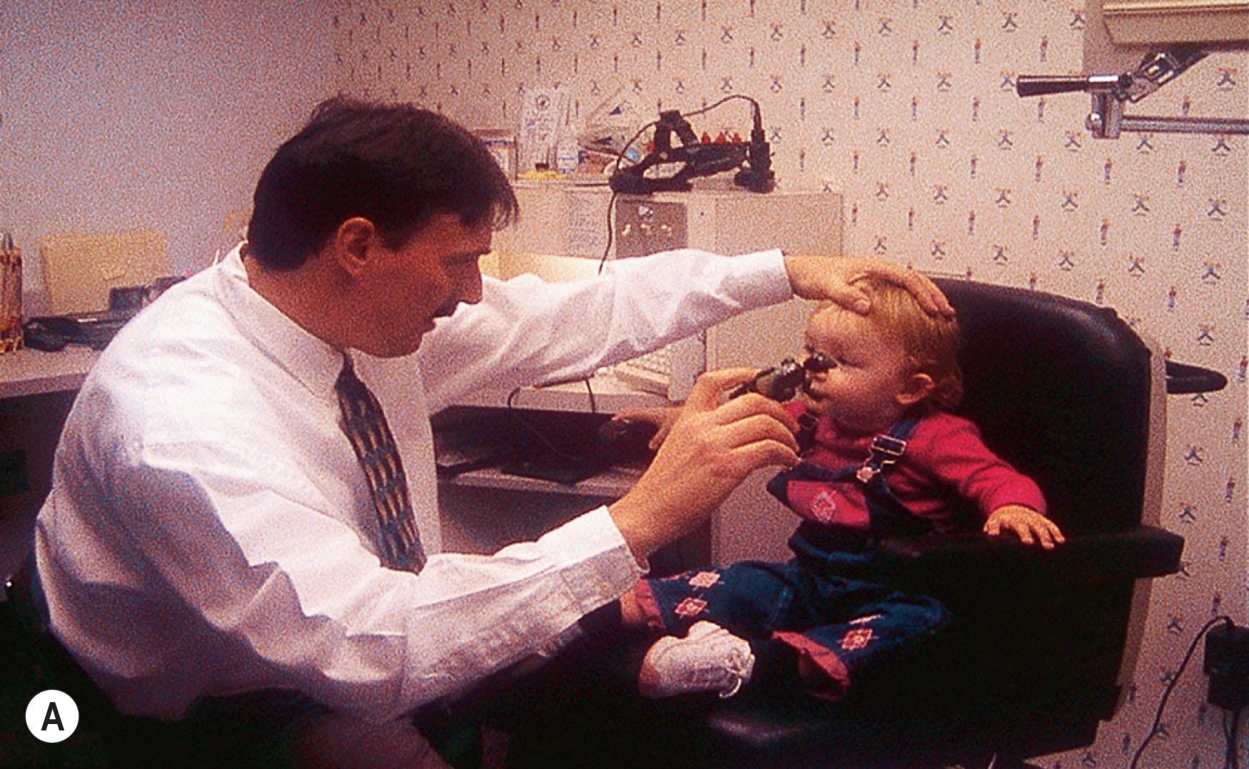 Fig. 91.9, Clinical evaluation of child voluntary saccadic eye movements. The child is seated while the head is held steady and targets are placed in the peripheral visual field horizontally (A, B) and vertically (C).