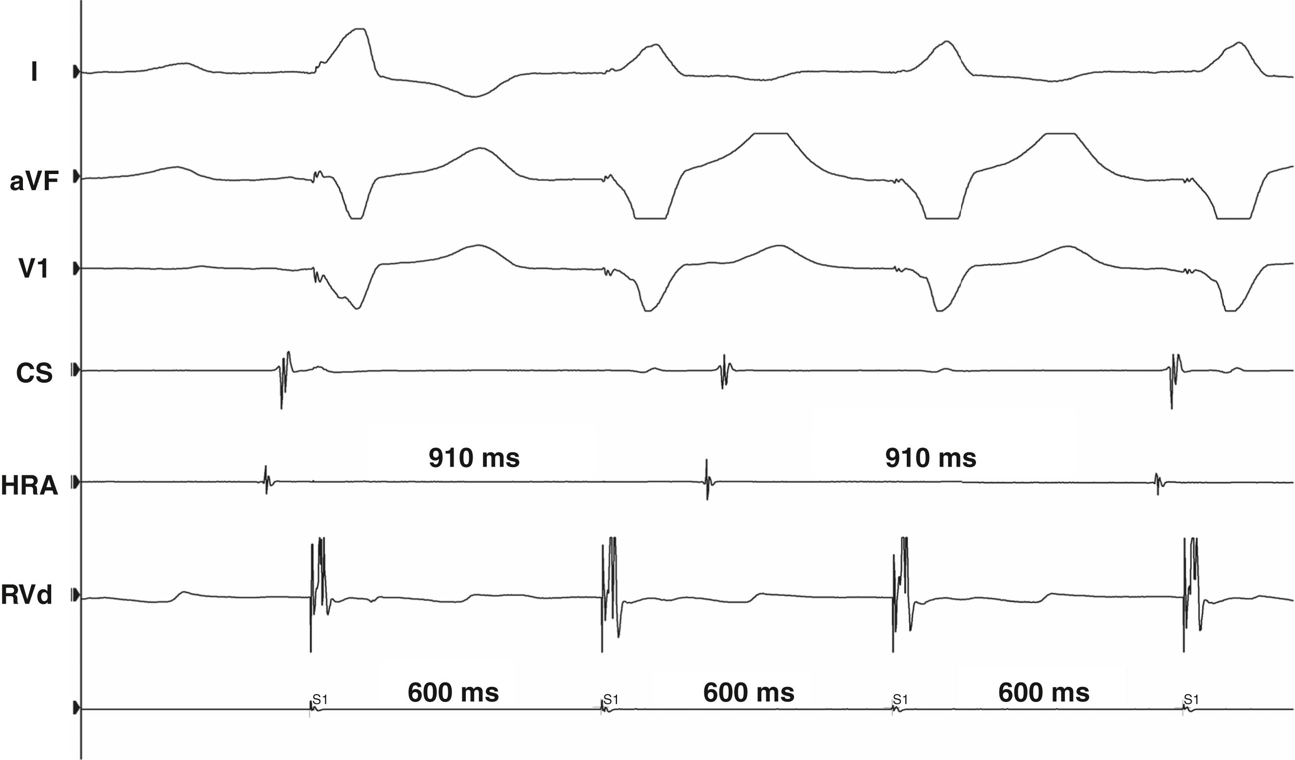 Fig. 70.4, Baseline observations: VA conduction.