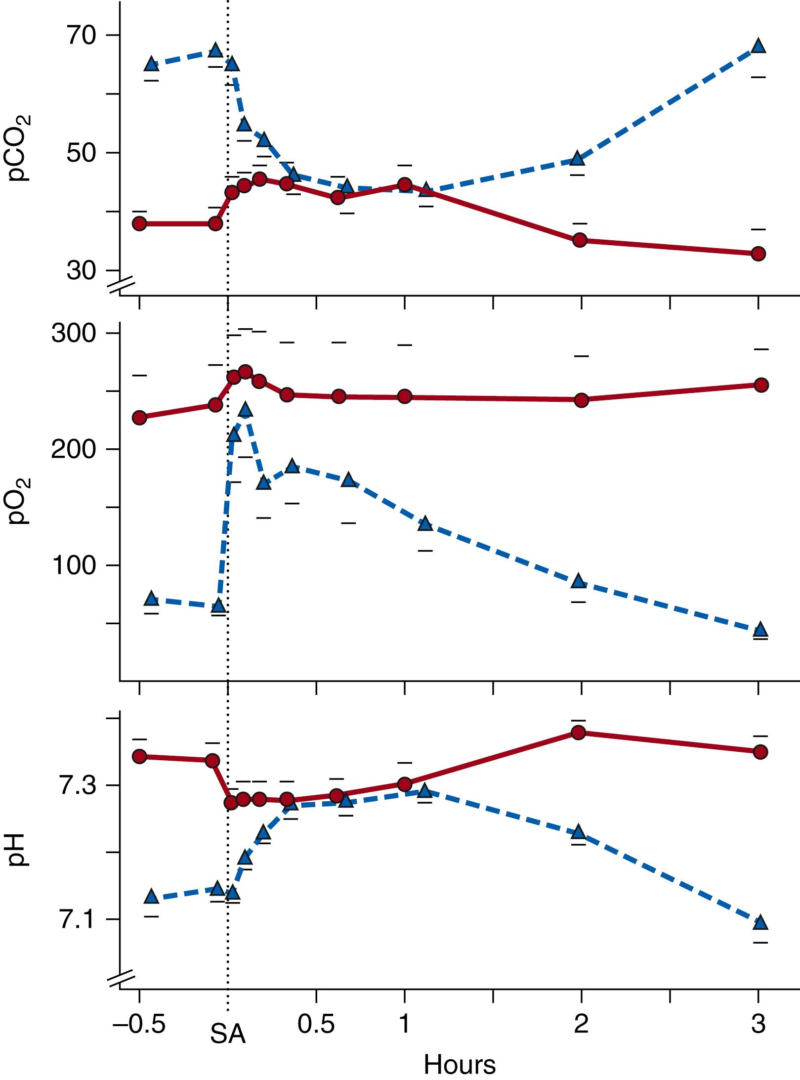 Fig. 79.5, Blood gas and pH responses of very preterm lambs to treatment with 100 mg/kg natural sheep surfactant from alveolar lavage. Preterm lambs were delivered at approximately 121 days of gestation (term is 150 days) and treated with surfactant either at birth (red dot) or after ventilation for approximately 30 minutes (SA) before surfactant treatment (blue triangle). Oxygenation was good and P co 2 values were normal with surfactant treatment at birth. Oxygenation improved very rapidly after surfactant treatment at 30 minutes of age, but the response did not persist because of lung injury from the initial period of ventilation before surfactant treatment.