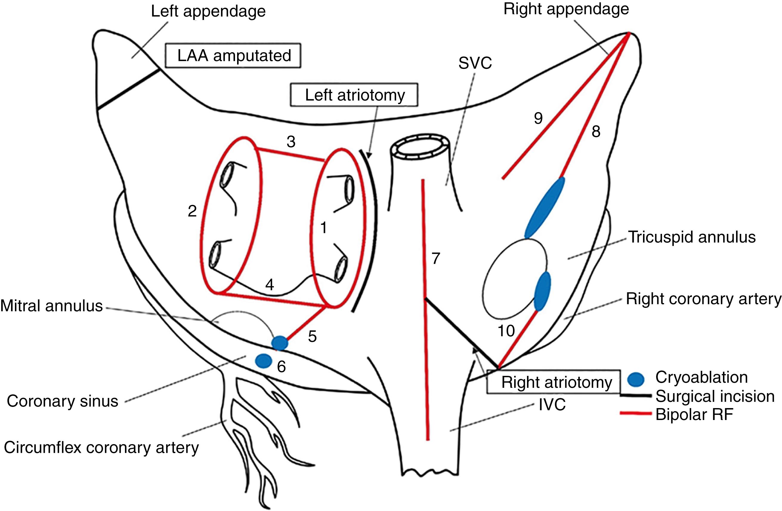 Fig. 135.2, Incisions, lesions, and energy sources typically used for the Cox-Maze IV procedure.