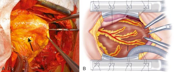 Figure 30.1