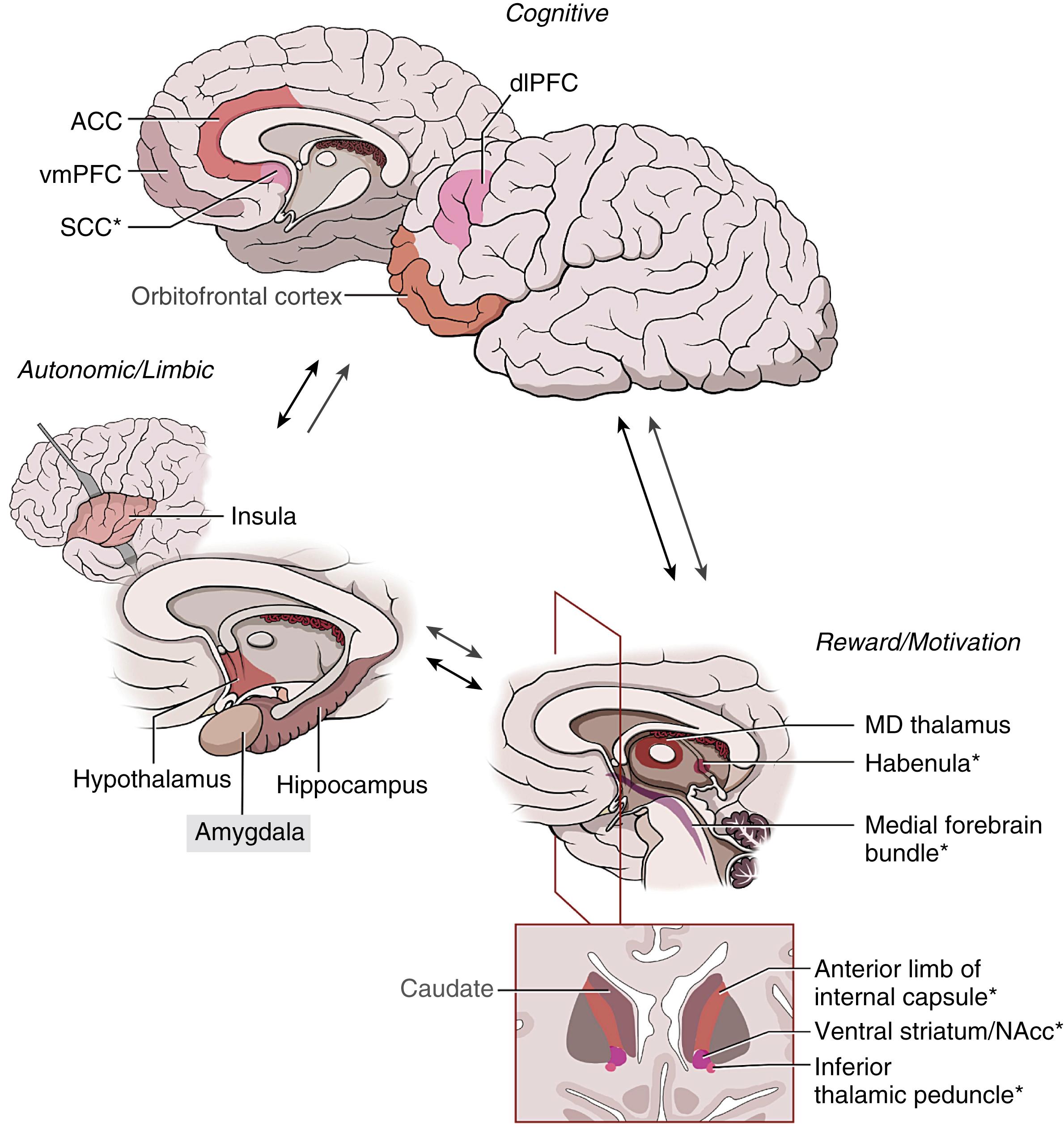 Figure 123.1, Circuit diagram for mood and anxiety disorders and deep brain stimulation targets.