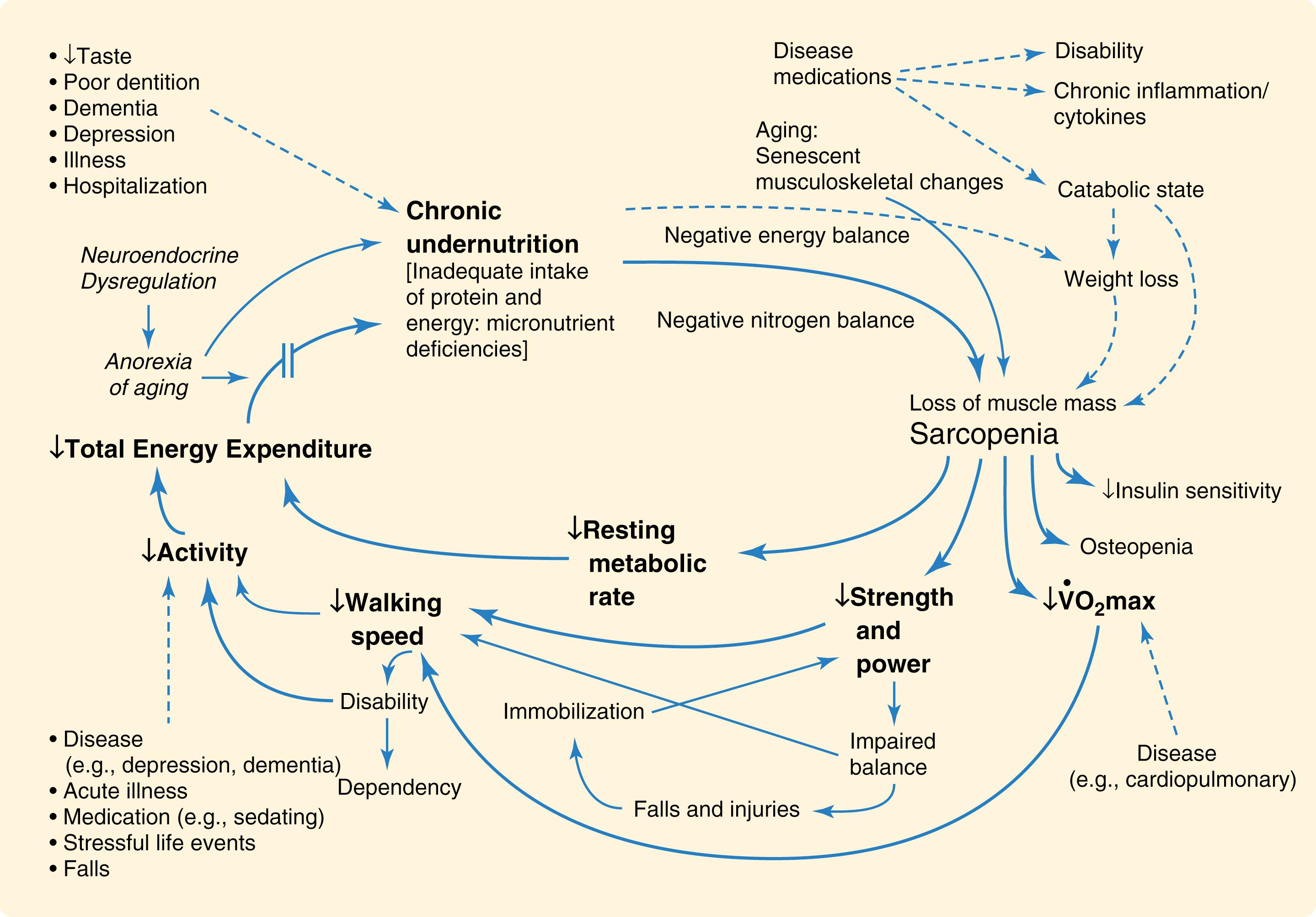 Fig. 13.4, The cycle of frailty is characterized by chronic undernutrition, loss of lean muscle mass (sarcopenia), and decreased exercise tolerance.