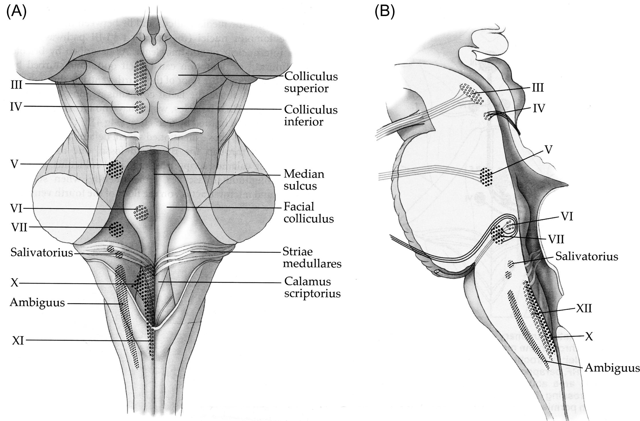 Figure 22.1, The positions of the cranial nerve motor nuclei are schematically projected on the dorsal surface of the brainstem (A) and outlined on the paramedian sagittal section (B). Awareness of their location may assist in selecting the safest surgical entry zone.