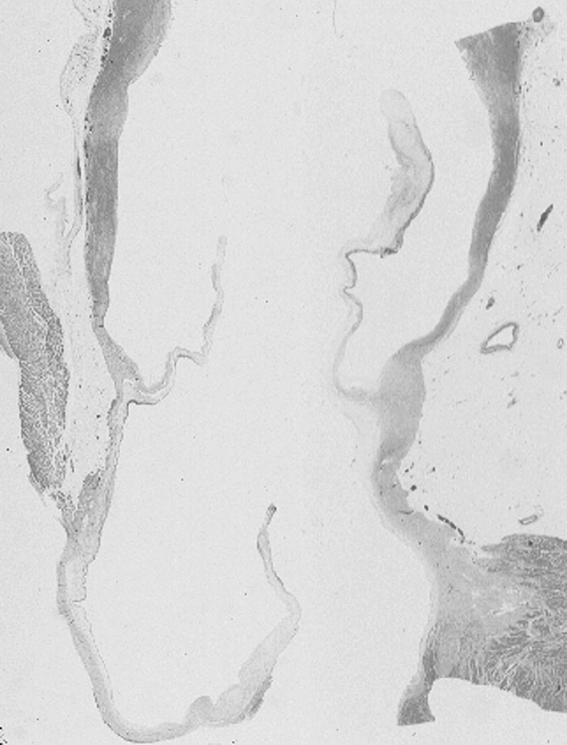 FIGURE 67-2, Microphotograph of the aortic annulus, cusps, and sinuses.