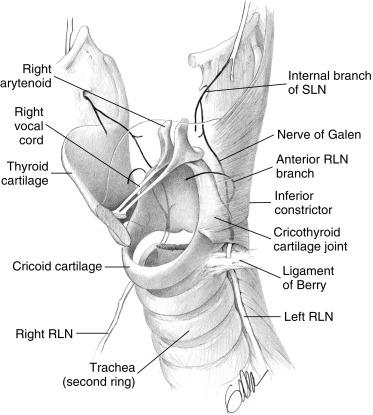 Fig. 36.6, Three-dimensional view of bilateral recurrent laryngeal nerve (RLN) entry into the larynx underneath the lower edge of the inferior constrictor, showing the anterior and posterior RLN branches within the larynx. The left thyroid lamina is not shown.