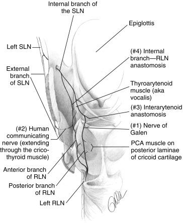 Fig. 36.7, Posterior view of the left hemilarynx, detailing four main anastomotic regions between the superior and recurrent laryngeal nerve (RLN) systems: (1) nerve of Galen, (2) human communicating nerve extending through cricothyroid muscle, (3) interarytenoid region anastomosis, and (4) superior laryngeal nerve (SLN) internal branch-RLN thyroarytenoid (TA) region anastomosis.