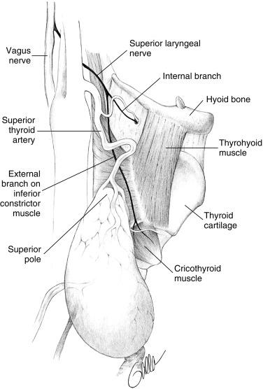 Fig. 35.1, External branch of the superior laryngeal nerve (EBSLN) descends from behind the carotid vessels, then crosses them medially, routing to the larynx.