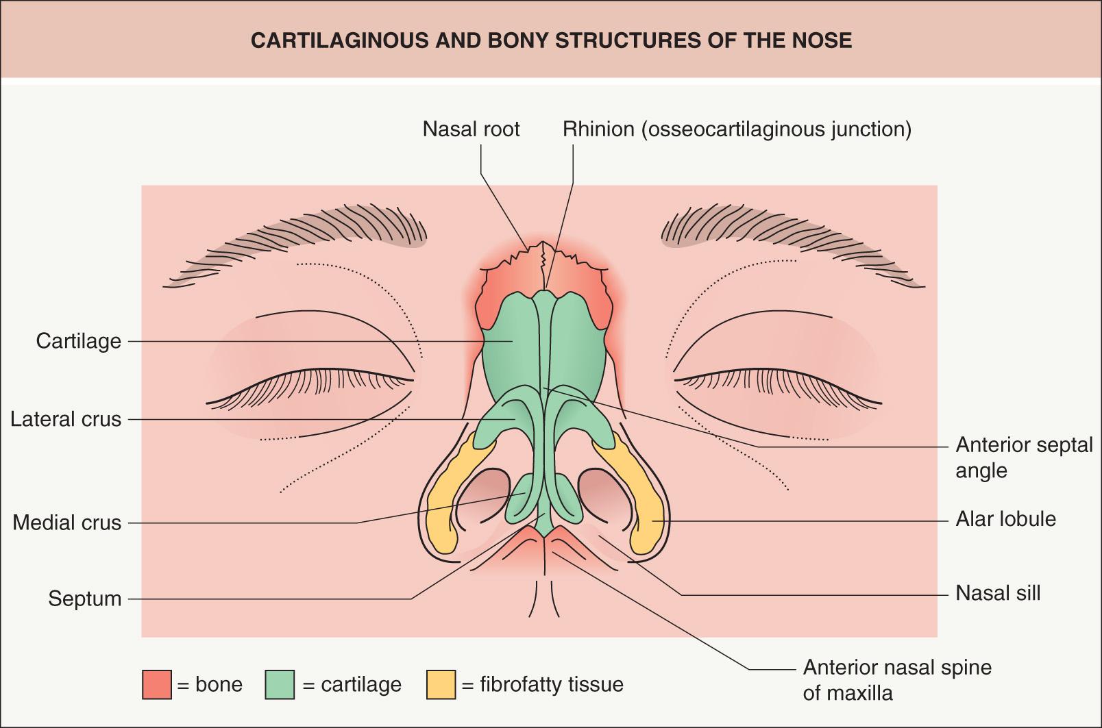 Fig. 142.11, Cartilaginous and bony structures of the nose.