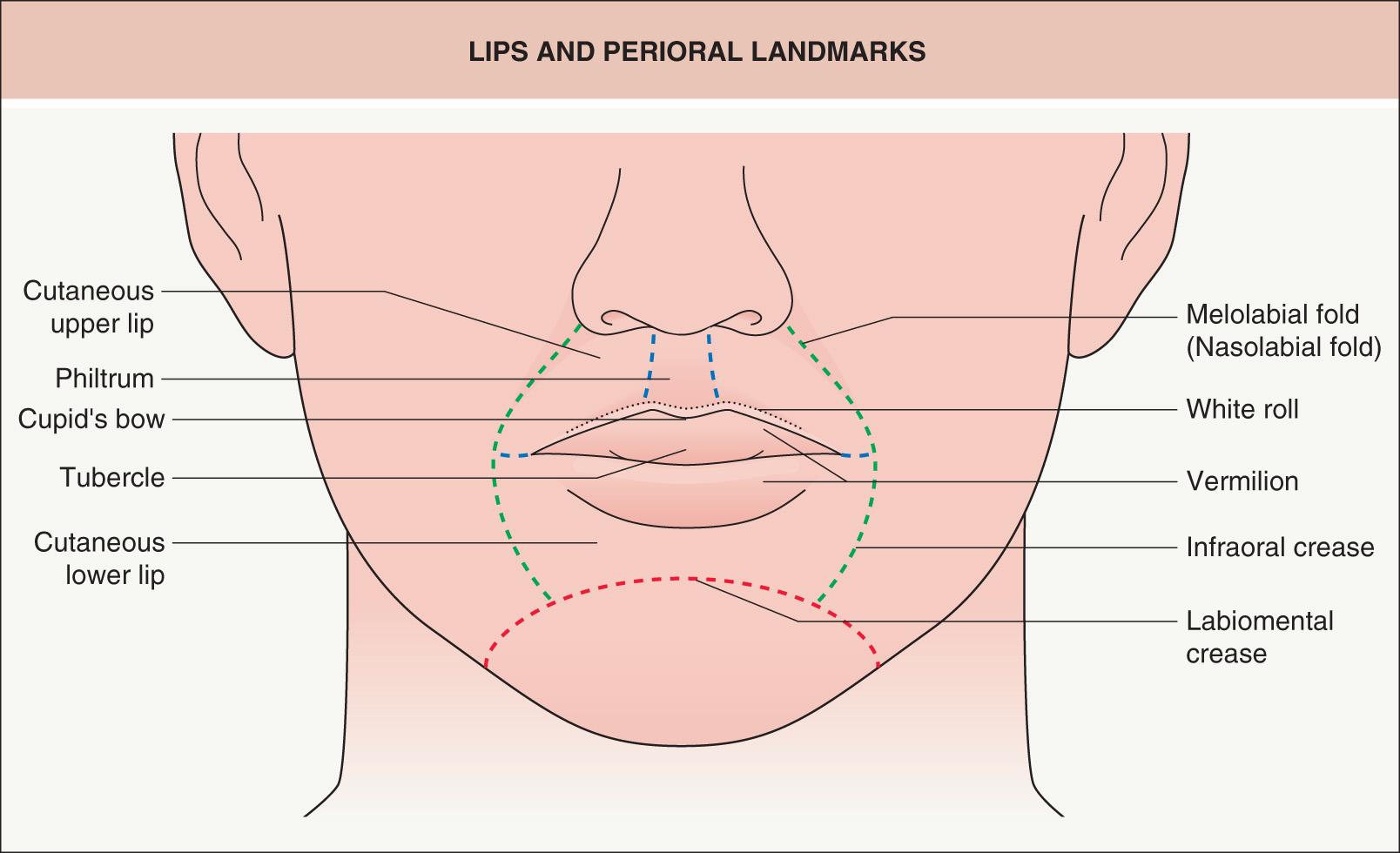 Fig. 142.12, Lips and perioral landmarks.