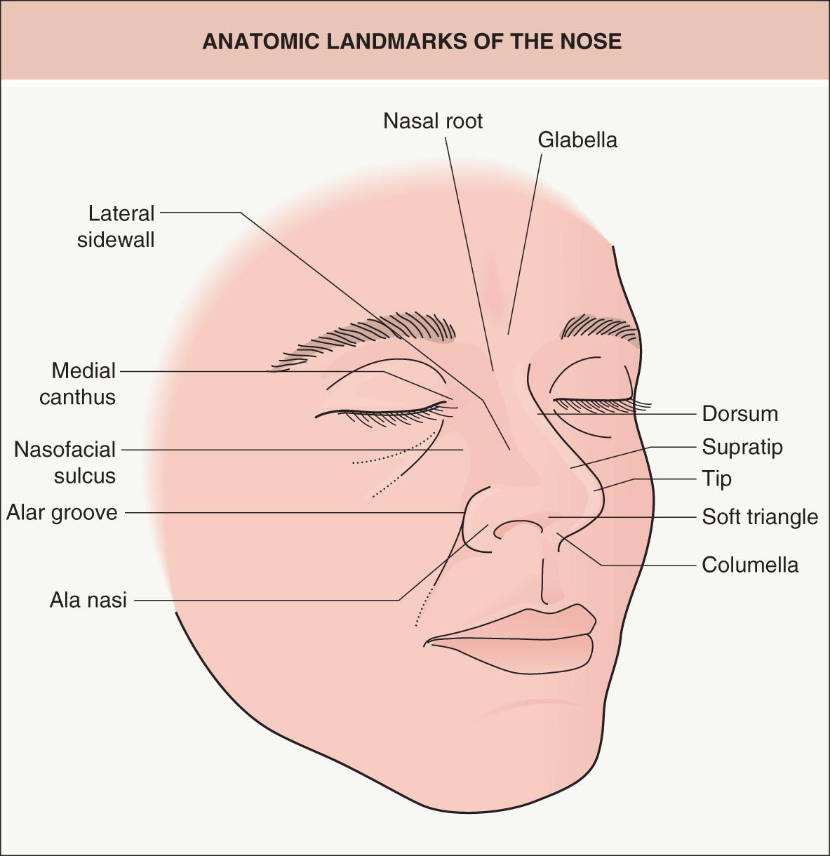 Fig. 142.10, Anatomic landmarks of the nose.