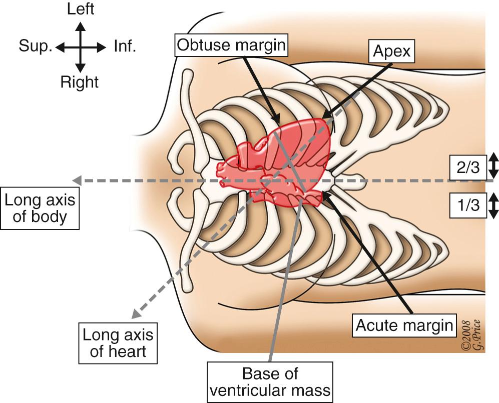 FIGURE 47-6, The cardiac structure placed in the context of the chest as would be seen by a surgeon standing on the right side of the operating table. Note that in the usual situation, two thirds of the cardiac silhouette are positioned to the left of the midline. Inf., Inferior; Sup., superior.