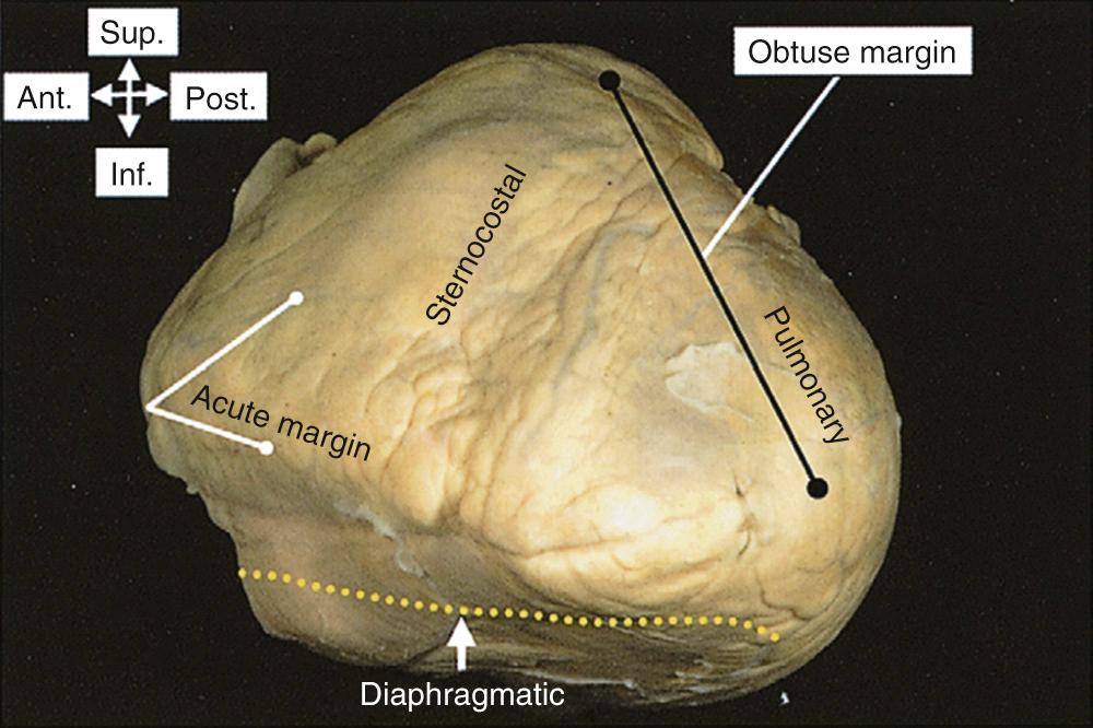 FIGURE 47-7, This heart has been removed from the thorax and is viewed from the apex, looking toward the base of the ventricular mass. It shows the surfaces of the ventricular mass and the locations of the acute and obtuse margins. Ant., Anterior, Inf., inferior; Post., posterior; Sup., superior.