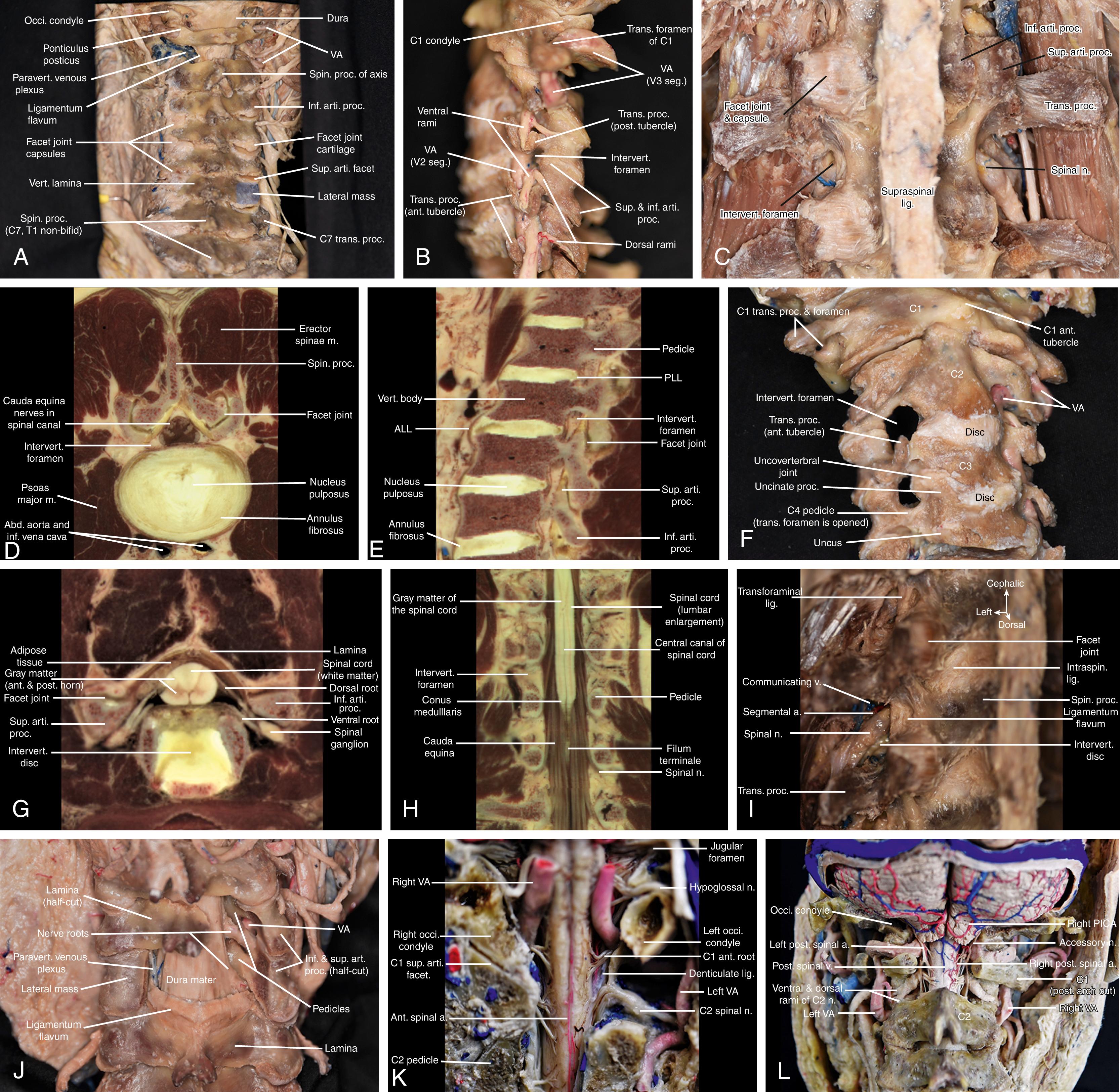 Figure 4.4, Overview of the osseous and ligamentous anatomy of the spine.