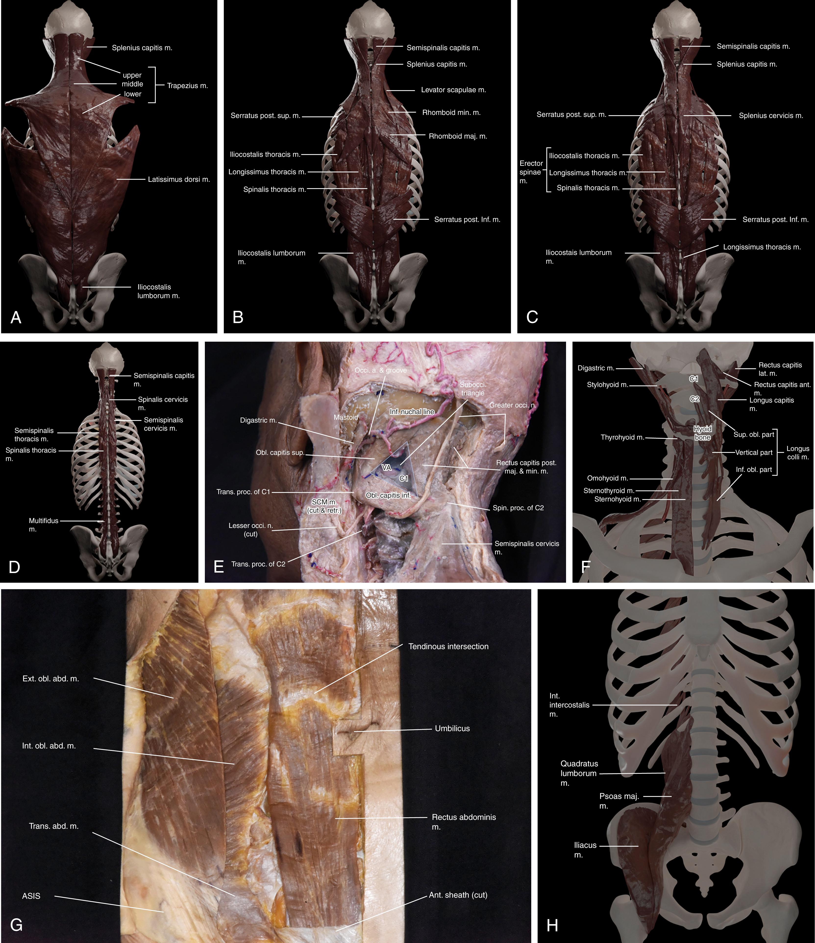 Figure 4.5, Spine-related muscles.