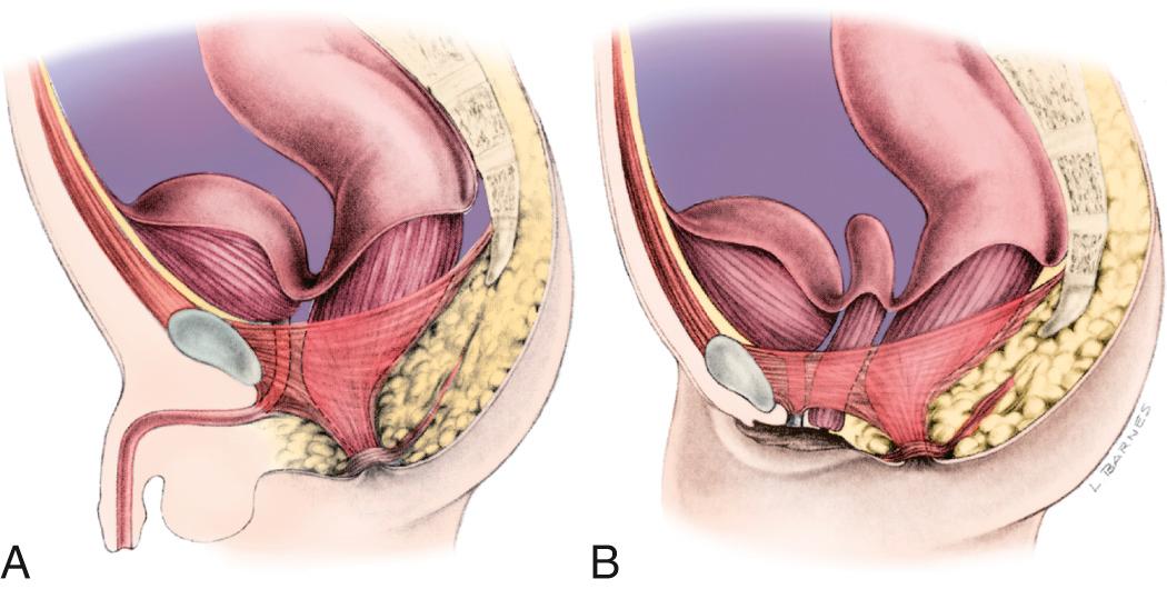 Fig. 371.1, Normal anorectal anatomy in relation to pelvic structures.