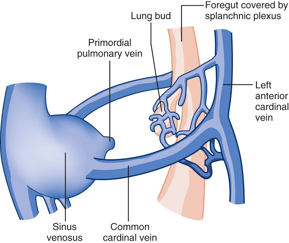 FIGURE 115-1, Lung buds arise from the primitive foregut with systemic venous drainage during early embryologic development. At later stages, an outpouching from the common atrium extends and bifurcates into the pulmonary venous plexus to establish drainage to the atrium, followed by regression of the systemic venous drainage.