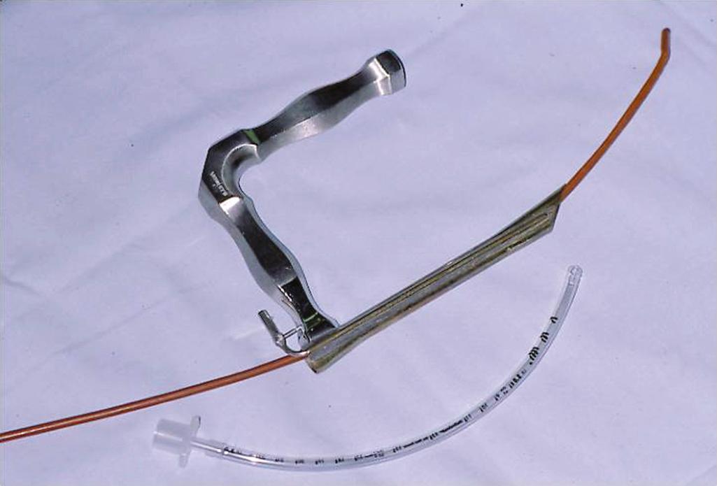 Fig. 6.1, The anterior commissure (Hollinger) laryngoscope is the most dependable scope for management of the difficult airway. Both cuffed and cuffless tubes may be passed through the scope, although the endotracheal tube size that can be fitted is limited. If a larger tube is required, intubation over an endotracheal tube introducer is possible.