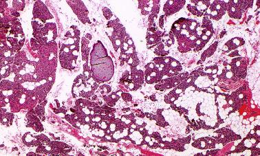 Fig. 65.1, Normal parathyroid gland from a middle-aged adult consisting of a mixture of chief cells and stromal fat cells.