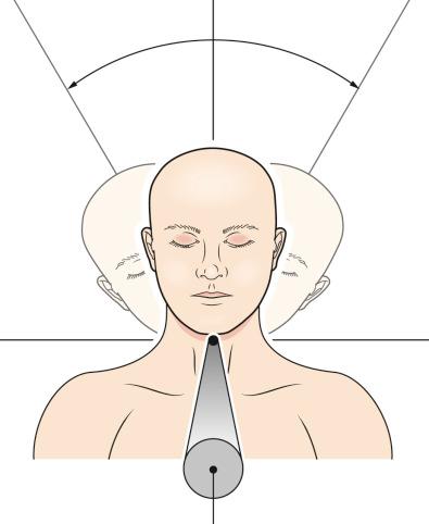 Figure 6.4, The axis of head movement in the coronal plane.