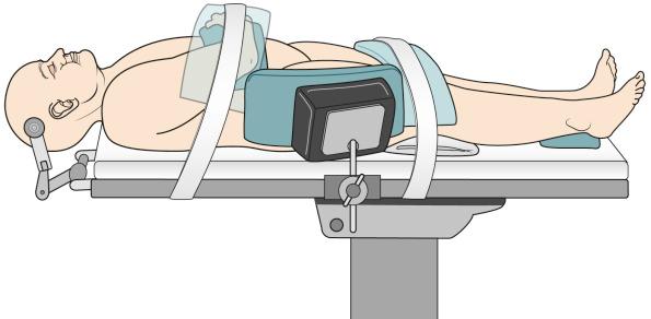 Figure 6.5, A side view of a straight supine position. The custom-made side rail–attached bolster is placed on the side of the patient for extra support.