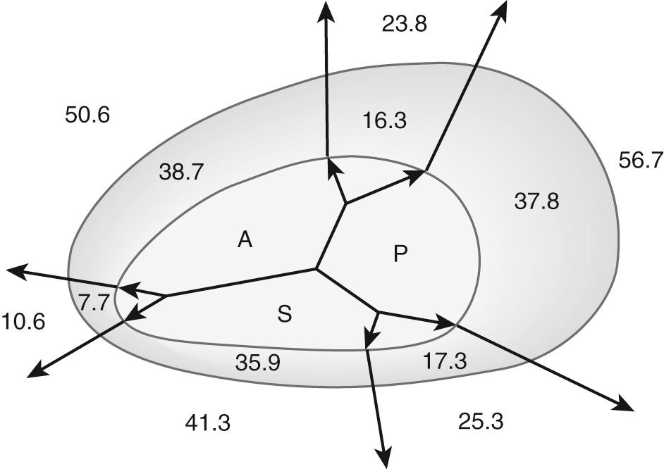 FIGURE 81-5, Diagram of the tricuspid valve annulus showing the normal (inner ellipse) and myxomatous (outer ellipse) valve in centimeters. A, anterior leaflet; P, posterior leaflet; S, septal leaflet.