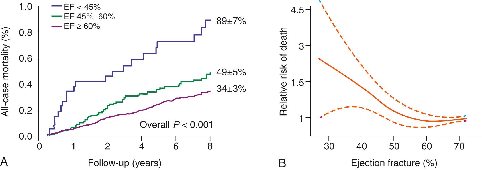 FIGURE 80-14, Impact of preoperative left ventricular dysfunction on survival under conservative management for mitral regurgitation. A, All-cause mortality stratified by ejection fraction (EF). B, Association between EF and the risk of all-cause death under conservative management. Hazard ratio (solid line) and 95% confidence intervals (dashed lines) were estimated in a Cox multivariable model with ejection fraction represented as a spline function and adjusted for sex, comorbidity index, symptoms, and coronary artery disease.