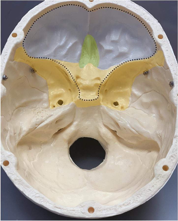 Surgical Anatomy Of The Anterior Cranial Fossa Clinical Tree 9423