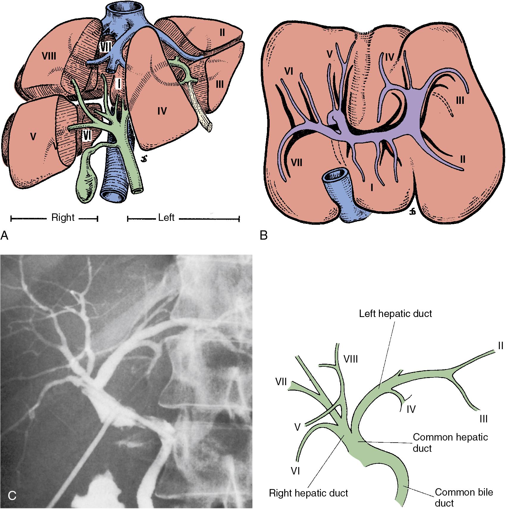 FIGURE 2.15, A, Biliary drainage of the two functional hemilivers. Note the position of the right anterior and right posterior sections. The caudate lobe drains into the right and left ductal system. B, Inferior aspect of the liver. The biliary tract is represented in black, and the portal branches are represented in white. Note the biliary drainage of segment IV (segment VIII is not represented because of its cephalad location). C, T-tube cholangiogram shows the most common arrangement of hepatic ducts.