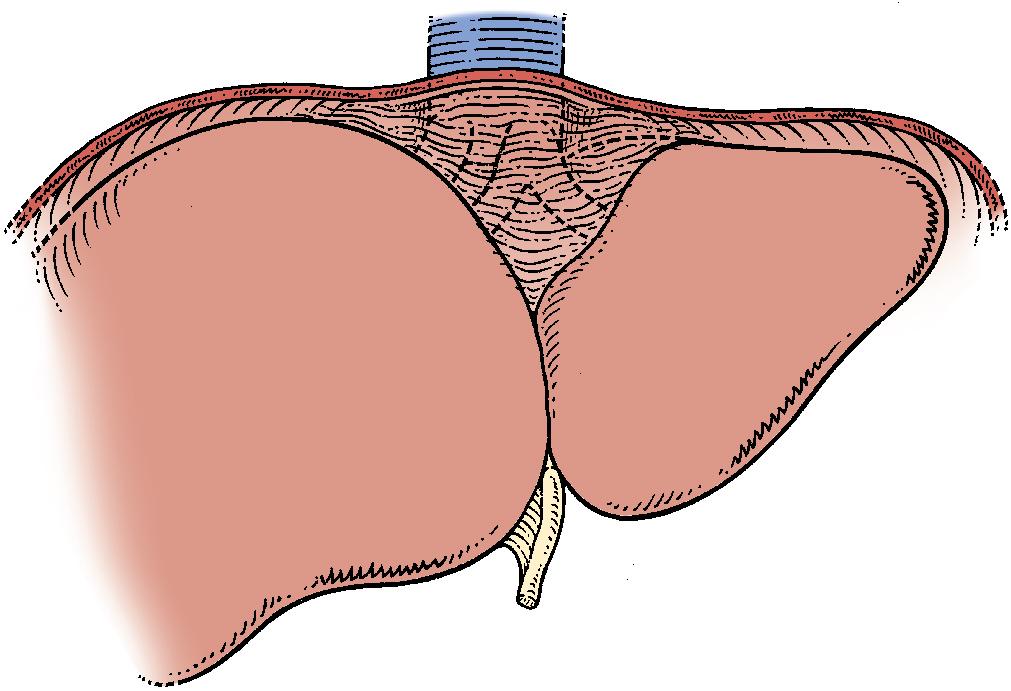 FIGURE 2.4, The anterior surfaces of the major extrahepatic veins and the inferior vena cava are retroperitoneal and masked behind the layers of the falciform ligament, while it splits and passes to the right and left triangular ligaments. The left and middle hepatic veins usually join within the liver and not outside the liver as depicted here for visual simplicity.