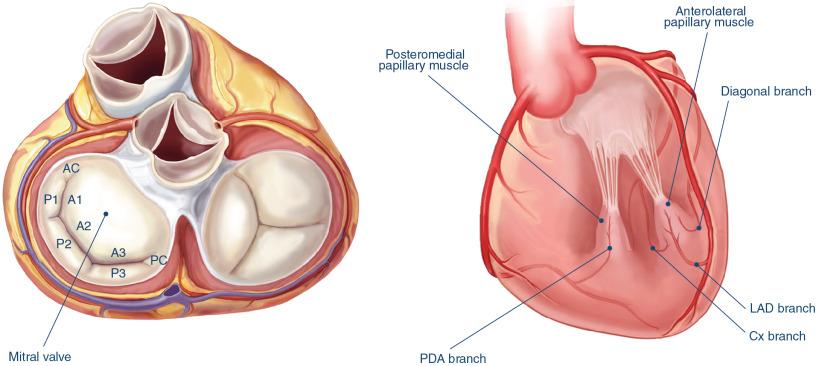 Fig. 19.1, Anatomic view of the cardiac valves in systole (left) . Anatomy and arterial supply of the papillary muscles of the left ventricle (right) . A1 , A2 , and A3 , Anterior leaflet scallops; AC , anterior commissure; Cx , circumflex; LAD , left anterior descending artery; P1 , P2 , and P3 , posterior leaflet scallops; PC , posterior commissure; PDA , posterior descending artery.