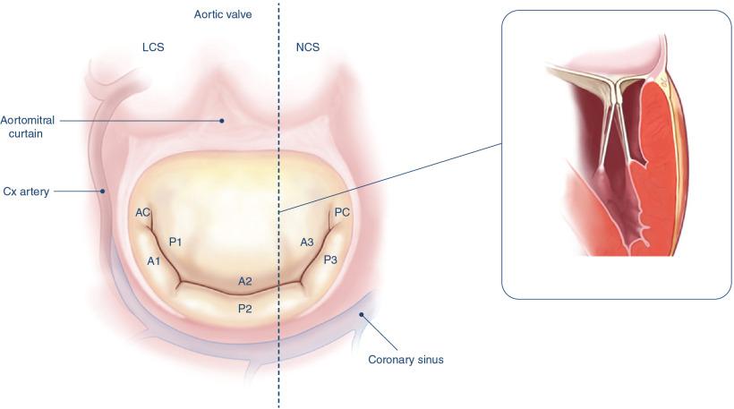 Fig. 19.2, Anatomic Structures Surrounding the Mitral Valve.
