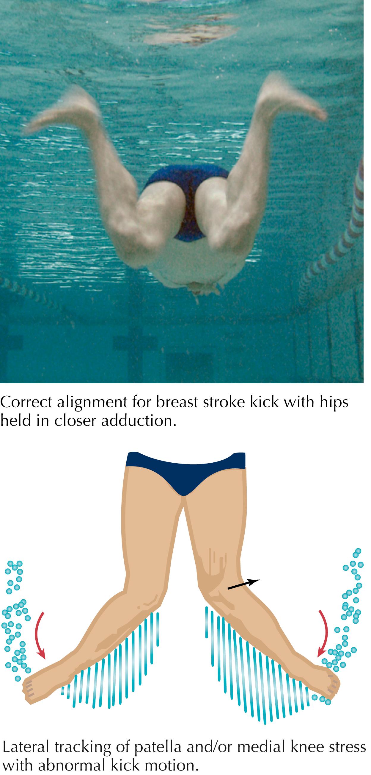 Figure 82.2, Knee pain associated with kick.