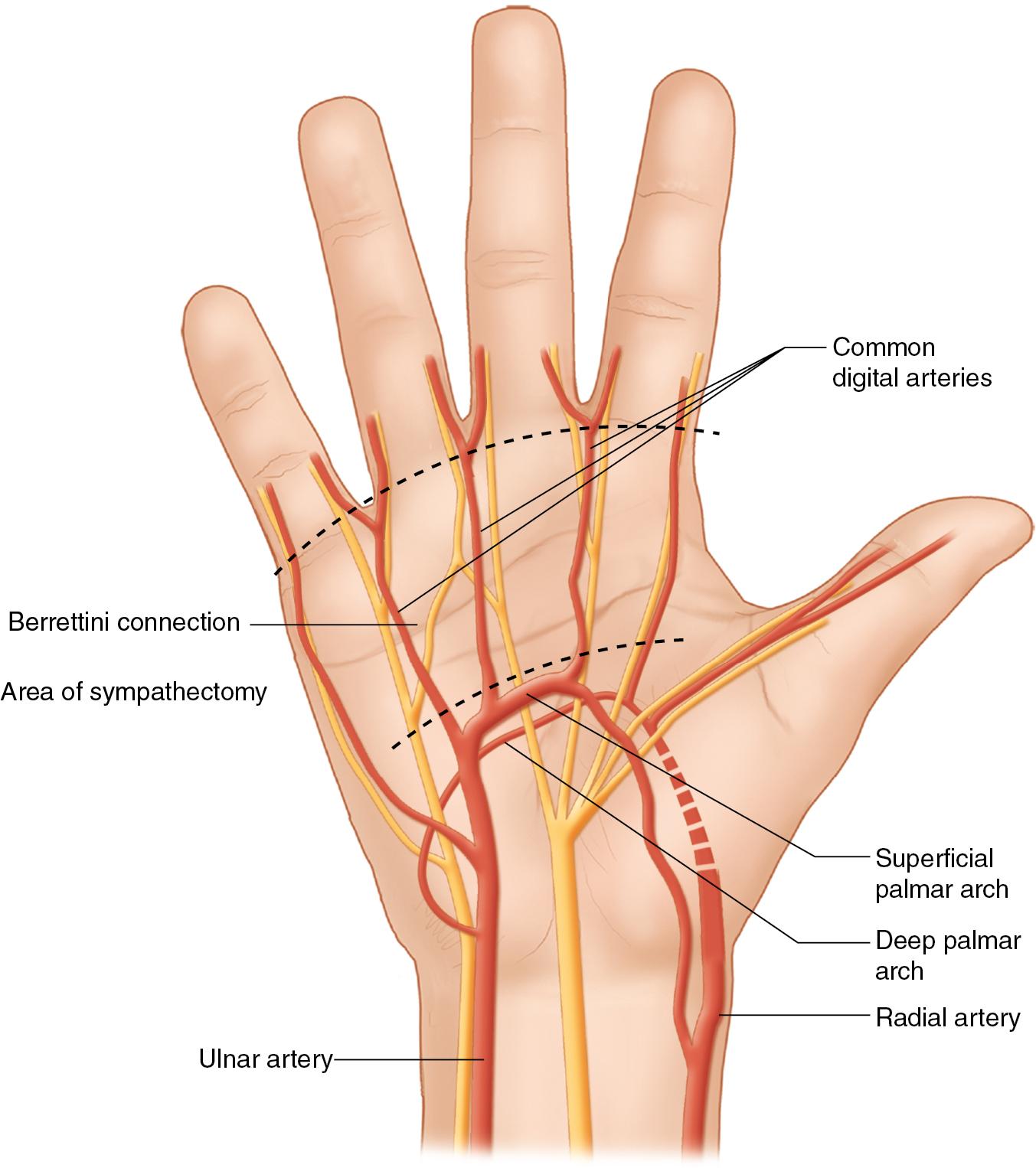 FIGURE 96.3, Note the branching of common digital arteries into proper digital arteries.